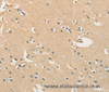 Immunohistochemistry of paraffin-embedded Human brain  using CHRNA2 Polyclonal Antibody at dilution of 1:40