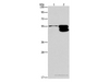 Western Blot analysis of NIH/3T3 cell and Mouse brain tissue using CRHR2 Polyclonal Antibody at dilution of 1:650