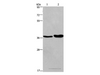 Western Blot analysis of Human testis tissue and transitional cell carcinoma of bladder tissue   using FUT1 Polyclonal Antibody at dilution of 1:250