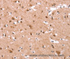 Immunohistochemistry of paraffin-embedded Human brain  tissue using KCNJ6 Polyclonal Antibody at dilution 1:40