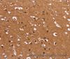 Immunohistochemistry of paraffin-embedded Human brain  using HDLBP Polyclonal Antibody at dilution of 1:50