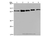 Western Blot analysis of MCF-7, 293T, A549, Hela and HepG2 cell using HNRNP L Polyclonal Antibody at dilution of 1:450