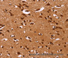 Immunohistochemistry of paraffin-embedded Human brain tissue using HRK Polyclonal Antibody at dilution 1:40