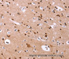 Immunohistochemistry of paraffin-embedded Human brain  tissue using ID4 Polyclonal Antibody at dilution 1:40