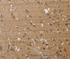 Immunohistochemistry of paraffin-embedded Human brain tissue using JAG1 Polyclonal Antibody at dilution 1:40