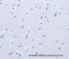 Immunohistochemistry of paraffin-embedded  using KCNMB3 Polyclonal Antibody at dilution of 1: