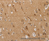 Immunohistochemistry of paraffin-embedded Human brain  using KCNQ4 Polyclonal Antibody at dilution of 1:40
