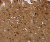 Immunohistochemistry of paraffin-embedded Human brain  tissue using CERS6 Polyclonal Antibody at dilution 1:35