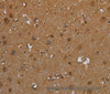 Immunohistochemistry of paraffin-embedded Human brain  tissue using SCGB1D2 Polyclonal Antibody at dilution 1:40