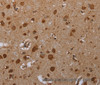 Immunohistochemistry of paraffin-embedded Human brain  tissue using ATP2A1 Polyclonal Antibody at dilution 1:30