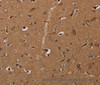 Immunohistochemistry of paraffin-embedded Human brain  using MOB1A Polyclonal Antibody at dilution of 1:30