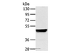 Western Blot analysis of Hela cell using NRF1 Polyclonal Antibody at dilution of 1:500