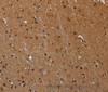 Immunohistochemistry of paraffin-embedded Human brain  tissue using PARP8 Polyclonal Antibody at dilution 1:40