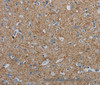 Immunohistochemistry of paraffin-embedded Human brain tissue using PGLYRP1 Polyclonal Antibody at dilution 1:40