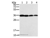 Western Blot analysis of Raji, Jurkat, 293T and hela cell using CENPV Polyclonal Antibody at dilution of 1:200