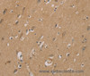 Immunohistochemistry of paraffin-embedded Human brain using RAD51 Polyclonal Antibody at dilution of 1:40