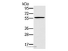 Western Blot analysis of Jurkat cell using TRIM34 Polyclonal Antibody at dilution of 1:250