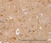 Immunohistochemistry of paraffin-embedded Human brain  using TRIM34 Polyclonal Antibody at dilution of 1:30