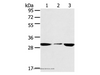 Western Blot analysis of PC3 and hepg2 cell, Human fetal liver tissue using SDHB Polyclonal Antibody at dilution of 1:400