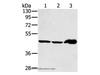 Western Blot analysis of Mouse liver tissue and PC3 cell, Human fetal liver tissue using SEC14L2 Polyclonal Antibody at dilution of 1:400
