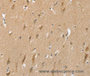 Immunohistochemistry of paraffin-embedded Human brain tissue using SLC6A7 Polyclonal Antibody at dilution 1:30