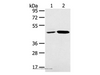 Western Blot analysis of K562 and Jurkat cell using SNX5 Polyclonal Antibody at dilution of 1:250