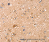 Immunohistochemistry of paraffin-embedded Human brain  tissue using TMSB10 Polyclonal Antibody at dilution 1:35