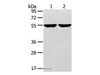 Western Blot analysis of 231 and hepg2 cell using TRIM62 Polyclonal Antibody at dilution of 1:400