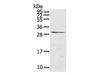 Western Blot analysis of Mouse kidney tissue using TNFSF15 Polyclonal Antibody at dilution of 1:600