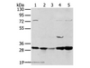 Western Blot analysis of 293T and MCF7 cell, Mouse brain tissue and K562 cell, Mouse bladder tissue using TPD54 Polyclonal Antibody at dilution of 1:400