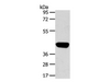 Western Blot analysis of Hepg2 cell using PRSS50 Polyclonal Antibody at dilution of 1:450