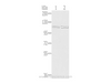 Western Blot analysis of A172 and 231 cells using SENP7 Polyclonal Antibody at dilution of 1/800
