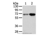 Western Blot analysis of Human lung cancer and placenta tissue using TBL1X Polyclonal Antibody at dilution of 1/500