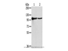 Western Blot analysis of K562 and A431 cells using TPX2 Polyclonal Antibody at dilution of 1/800