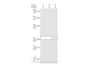 Western Blot analysis of Human fetal brain and placenta tissue, Mouse brain tissue using TALDO1 Polyclonal Antibody at dilution of 1/400