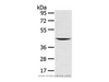 Western Blot analysis of Mouse kidney tissue using VSIG8 Polyclonal Antibody at dilution of 1/400