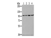 Western Blot analysis of K562, 293T, 231 and Hela cells using NUP98 Polyclonal Antibody at dilution of 1/550