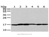 Western Blot analysis of A431 cells and Human liver cancer tissue, Lovo and PC3 cells, Human placenta tissue and 293T cells using UTS2B Polyclonal Antibody at dilution of 1/200