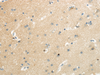 Immunohistochemistry of paraffin-embedded Human brain using SLC7A11 Polyclonal Antibody at dilution of  1/35