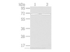 Western Blot analysis of A431 and hela cell using ARFGAP2 Polyclonal Antibody at dilution of 1/200