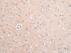 Immunohistochemistry of paraffin-embedded Human brain tissue using GJB5 Polyclonal Antibody at dilution 1:45