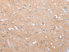 Immunohistochemistry of paraffin-embedded Human brain tissue using COLEC12 Polyclonal Antibody at dilution 1:40
