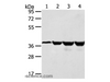 Western Blot analysis of Human normal liver tissue and hepg2 cell, Jurkat and K562 cell using HMOX2 Polyclonal Antibody at dilution of 1:550