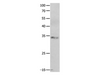 Western Blot analysis of Jurkat cell using RBFOX3 Polyclonal Antibody at dilution of 1:550