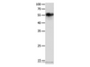 Western Blot analysis of Hela cell using CHRNA3 Polyclonal Antibody at dilution of 1:600