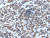 Immunohistochemistry of paraffin-embedded Human tonsil tissue  using APOD Polyclonal Antibody at dilution of 1:55(×200)