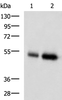Western blot analysis of Human placenta tissue and Human right lower lung tissue lysates  using BMP5 Polyclonal Antibody at dilution of 1:450