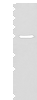 Western blot analysis of HEPG2 cell lysate  using CYP11B2 Polyclonal Antibody at dilution of 1:650