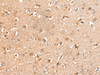 Immunohistochemistry of paraffin-embedded Human brain tissue  using KLHL36 Polyclonal Antibody at dilution of 1:55(×200)