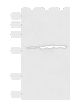 Western blot analysis of Mouse heart tissue Human heart tissue Rat heart tissue lysates  using CAMK2G Polyclonal Antibody at dilution of 1:400